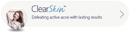 Clearskin acne laser treatment
