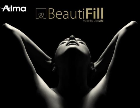 Alma Launches BeautiFill