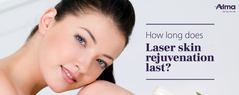 How long does Laser skin rejuvenation last