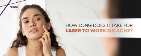 How long does it take for laser to work on acne